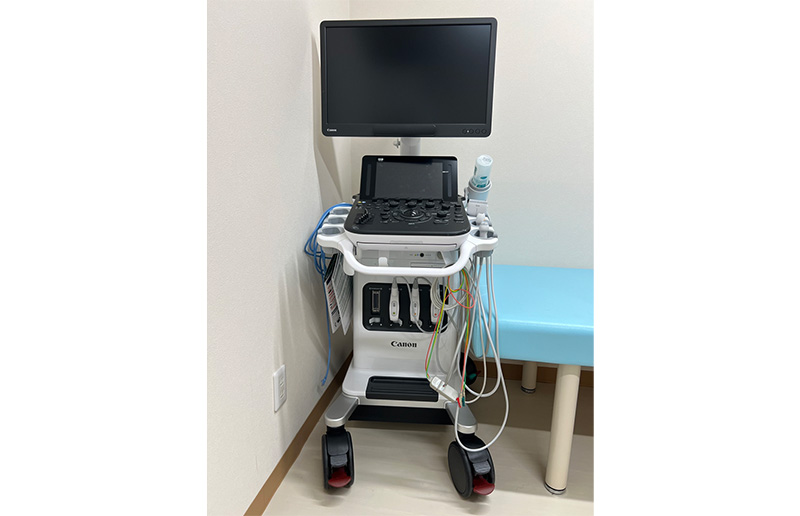 超音波診断装置